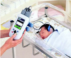 Sàng lọc khiếm thính ở trẻ sơ sinh bằng đo đáp ứng thính lực thân não
