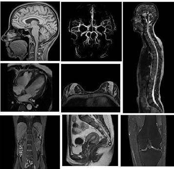 Hình chụp cộng hưởng từ MRI