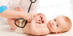 Thủy đậu, quai bị, viêm kết mạc vào mùa