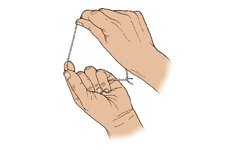 Bệnh lý nha chu: Phòng bệnh hơn chữa bệnh