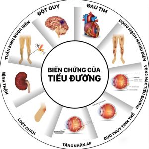 biến chứng tiểu đường tuyp 2