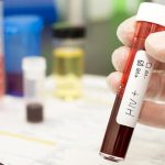 HIV-test-HIV-va-cac-xet-nghiem-mau-quan-trong-khac-khi-mang-thai