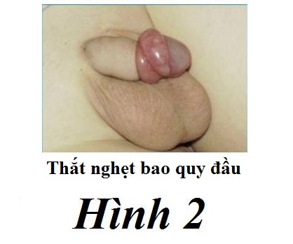 Hình 2