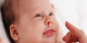 Nguyên nhân và cách xử lý khi trẻ bị chảy máu cam