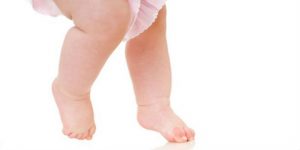 Trật khớp háng bẩm sinh