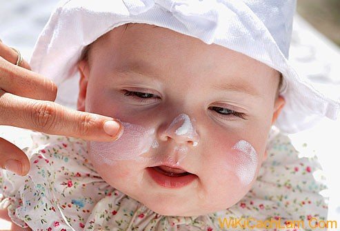 Điều trị chàm (lác sữa) ở trẻ em
