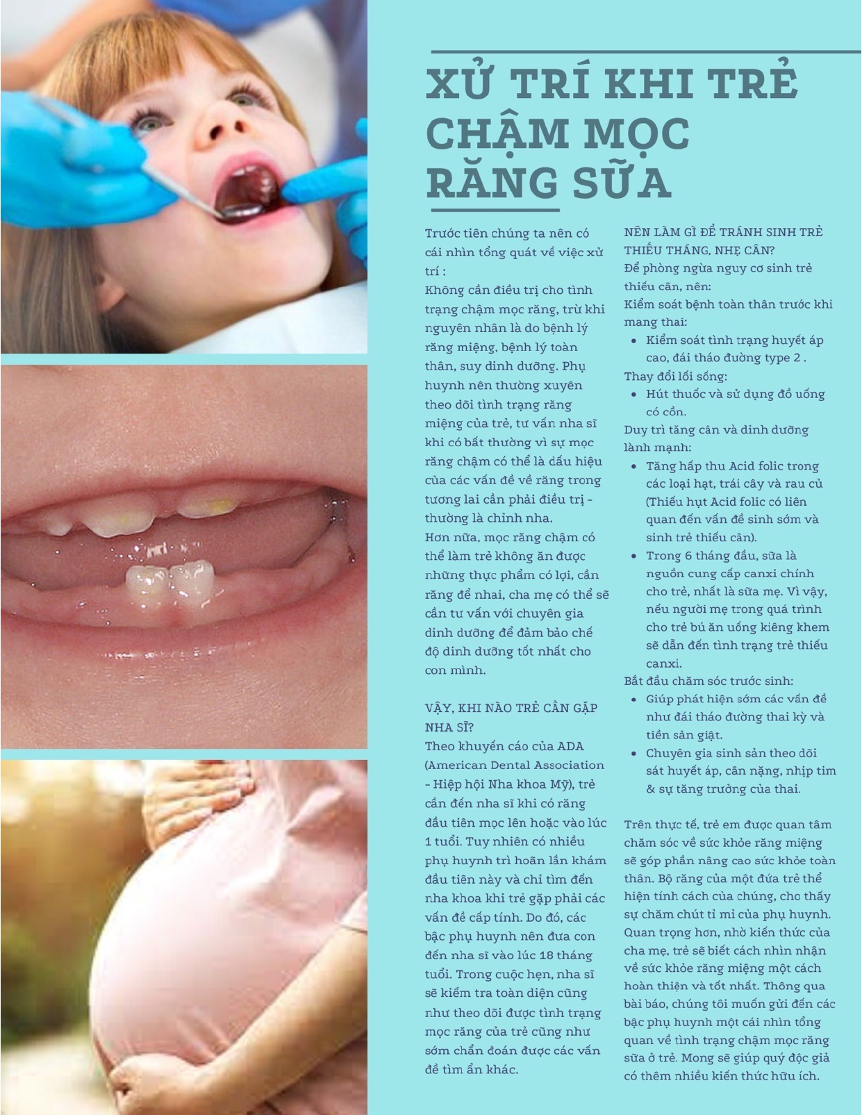 Trẻ chậm mọc răng sữa có đáng lo ngại?