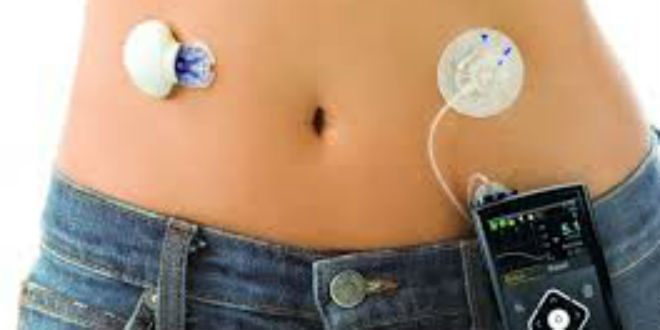 Máy đo đường huyêt CGM