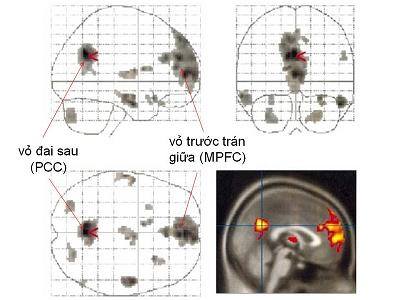 (f-MRI) Sự kích hoạt của các vùng não khi con người ý thức về cái " ta " (self-awareness) hay quan tâm đến cái " ta " (self-preoccupation)