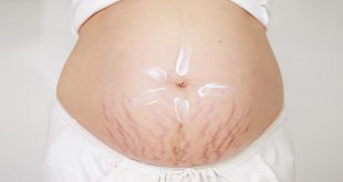 Những thay đổi ngoài da ở phụ nữ có thai