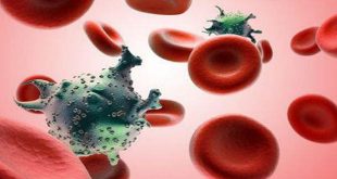 Điểm mới trong nghiên cứu và điều trị ung thư máu dòng lympho mãn tính (CLL)