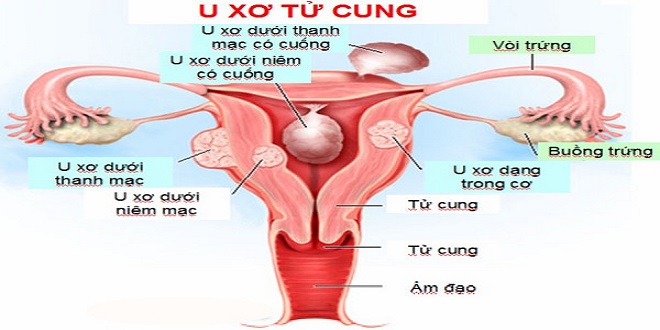 Nguyên nhân và biểu hiện của bệnh ung thư cổ tử cung  Phòng Khám Đa Khoa  Hoàn Mỹ Sài Gòn