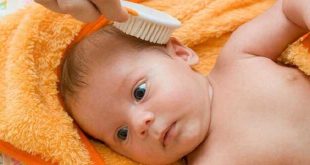 Rụng tóc trong ung thư trẻ em