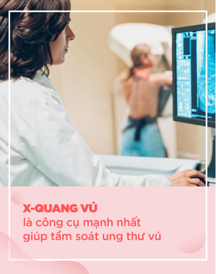10 lưu ý quan trọng khi chụp X-quang vú - "công cụ mạnh nhất" để tầm soát ung thư vú