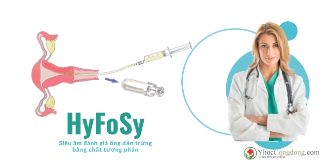 Phương pháp HyFoSy là dùng chất tương phản an toàn bơm vào buồng tử cung qua ngả âm đạo và quan sát sự thay đổi hình ảnh chất tương phản qua hai ống dẫn trứng.